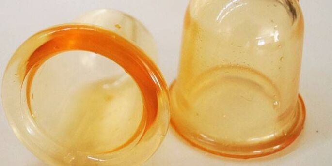 чаши за лечение на простатит